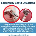 emergency 24 hour dental extraction get fast relief now