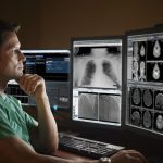 unlocking healthcare secrets discoveries from tully health center radiology