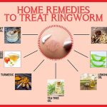ringworm home treatment effective remedies to get rid of ringworm