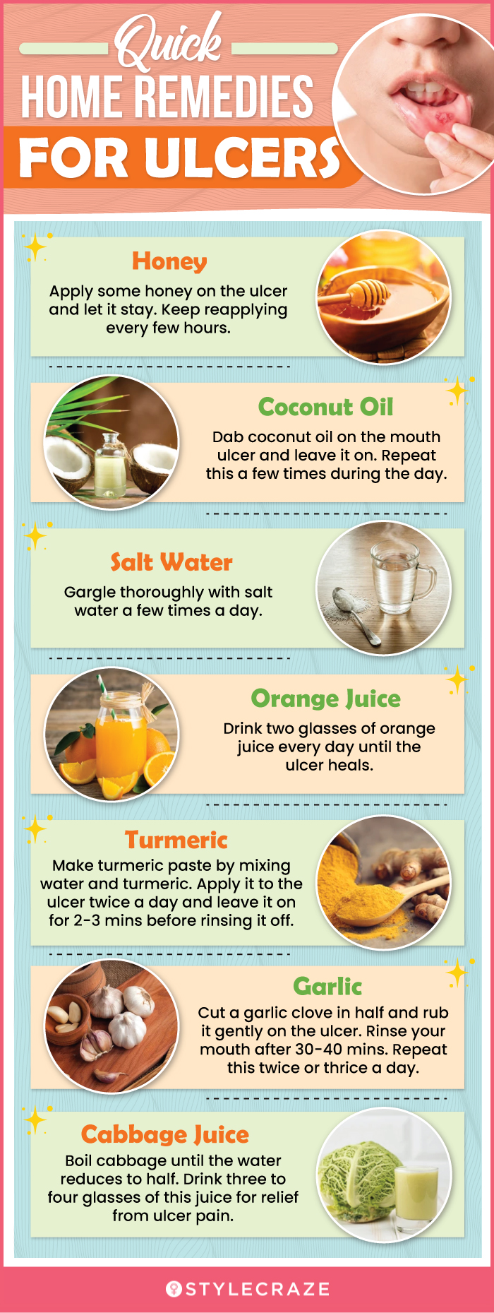 throat ulcer treatment at home tips and remedies